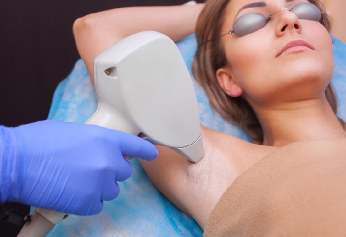 Laser hair removal in Hyderabad at SkinVive by Dr. Karishni Chittarvu