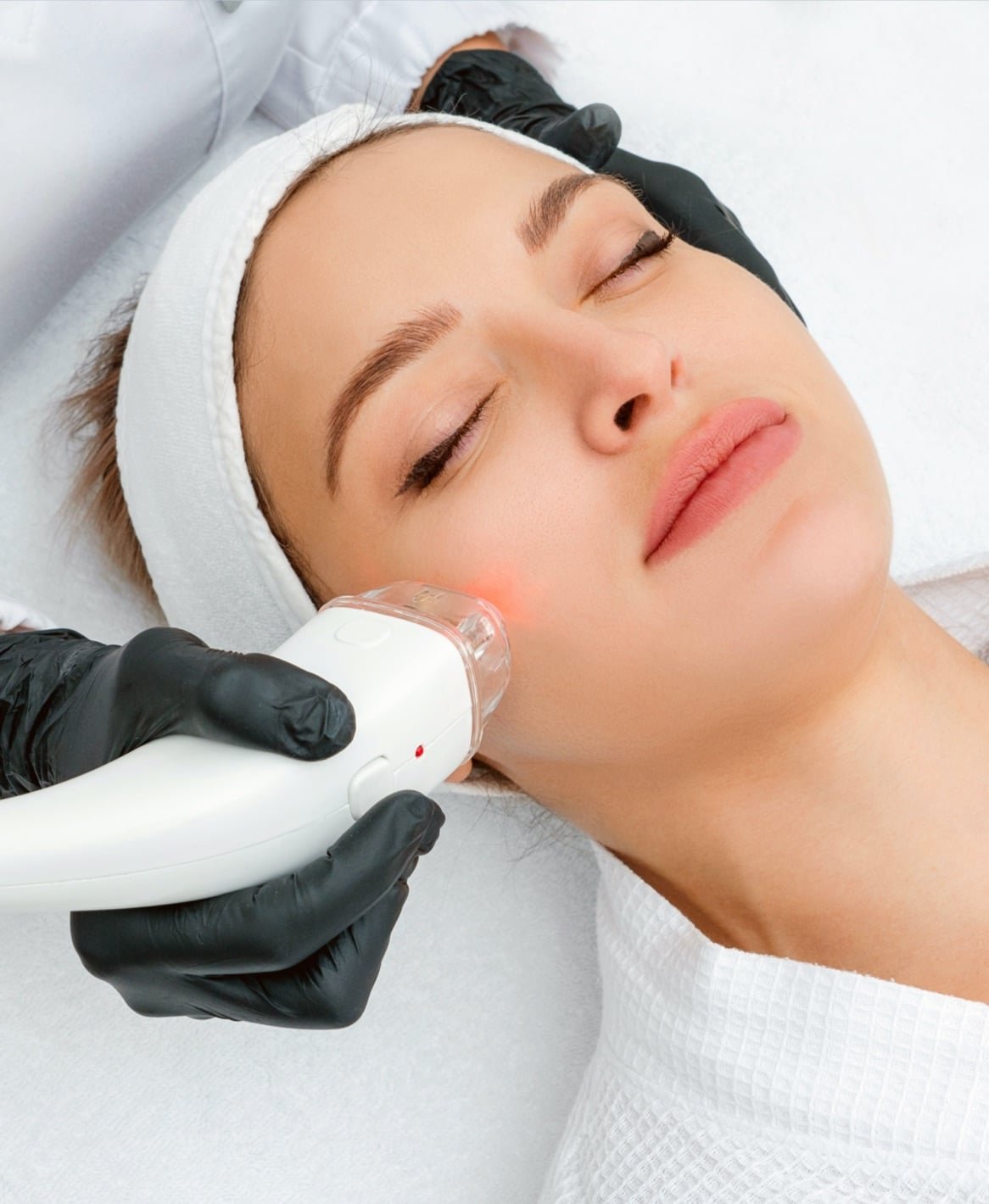 Laser Treatments at SkinVive in Hyderabad by Dr. Karishni Chittarvu