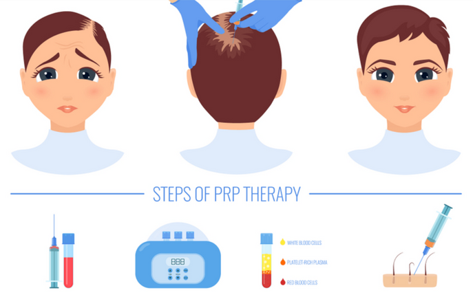 Working of PRP for hair at SkinVive in Hyderabad by Dr. Karishni Chittarvu